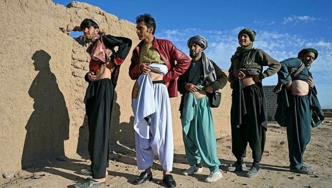 Ngày càng có nhiều người Afghanistan sẵn sàng bán nội tạng của mình để cứu gia đình khỏi chết đói. Ảnh: Wakil KOHSAR AFP Ngày càng có nhiều người Afghanistan sẵn sàng bán nội tạng của mình để cứu gia đình khỏi chết đói. Ảnh: Wakil KOHSAR AFP