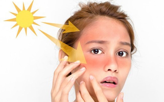 Cách phòng, tránh tác hại của ánh nắng mặt trời bạn cần biết. Ảnh minh hoạ