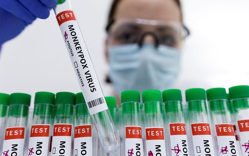 Ống đựng mẫu bệnh phẩm dương tính với virus gây bệnh đậu mùa khỉ. (Ảnh: Reuters) Ống đựng mẫu bệnh phẩm dương tính với virus gây bệnh đậu mùa khỉ. (Ảnh: Reuters)