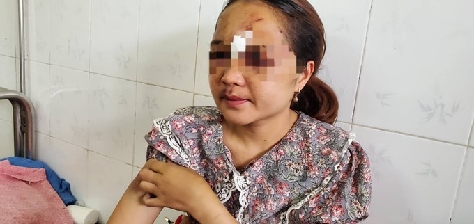 Chị B bị chồng đánh giữa đường