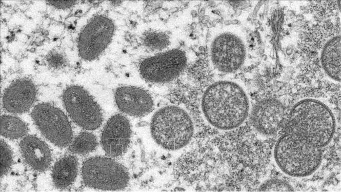 Hình ảnh dưới kính hiển vi do Trung tâm kiểm soát và phòng ngừa dịch bệnh công bố về virus đậu mùa khỉ