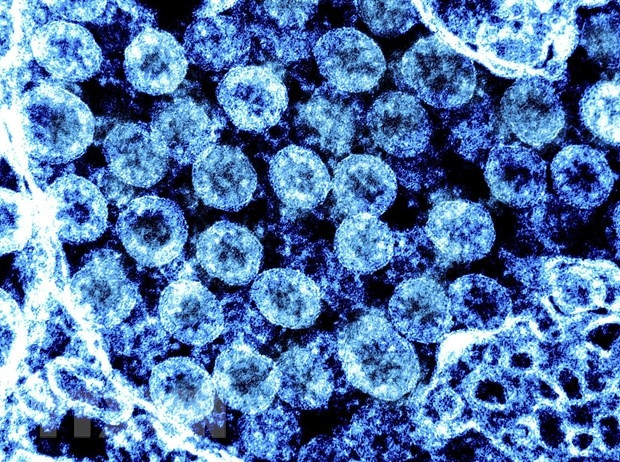 Hình ảnh từ kính hiển vi virus SARS-CoV-2 trong mẫu bệnh phẩm của bệnh nhân mắc COVID-19. (Ảnh: AFP/TTXVN)