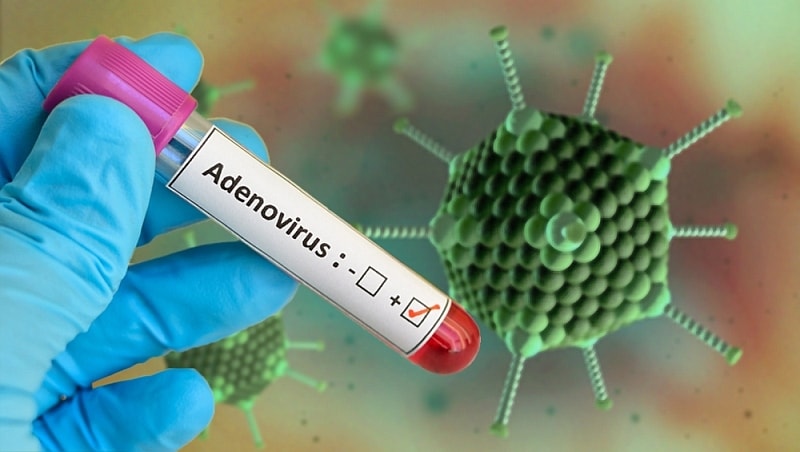 (Tổng hợp) Bộ Y tế ban hành hướng dẫn chẩn đoán điều trị, phòng bệnh do virus Adeno 1