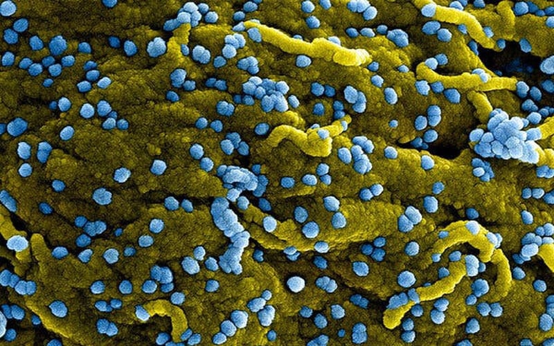 Virus Marburg (màu xanh lam), vừa sinh sôi và gắn trên bề mặt của các tế bào bị nhiễm bệnh (màu vàng). Virus Marburg (màu xanh lam), vừa sinh sôi và gắn trên bề mặt của các tế bào bị nhiễm bệnh (màu vàng).