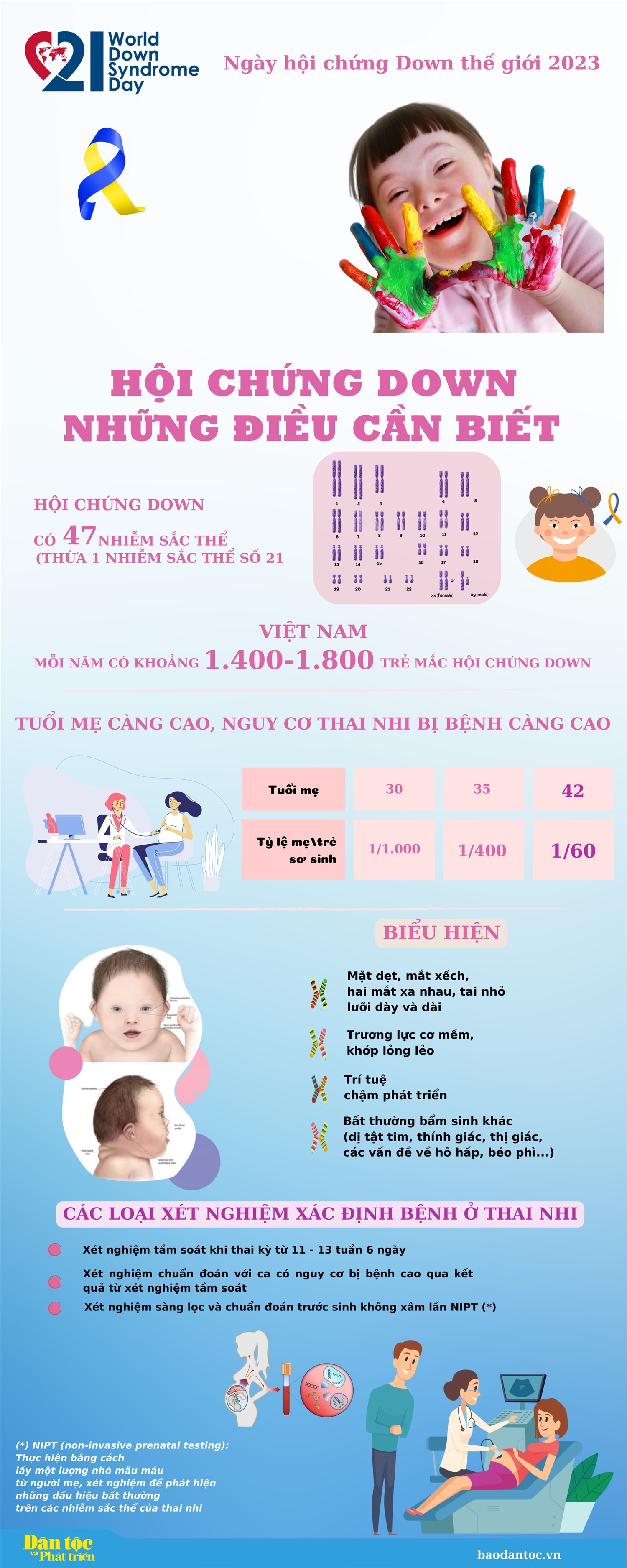 (inforgraphic) Hội chứng Down: Những điều cần biết