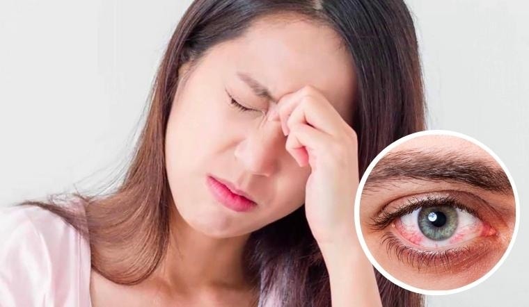 (Tổng hợp) Cách phòng trị căn bệnh đau mắt đỏ 2