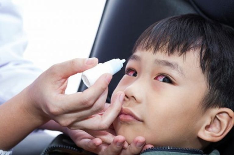 (Tổng hợp) Cách phòng trị căn bệnh đau mắt đỏ