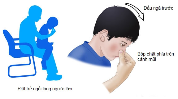 Cách chữa chảy máu cam cho trẻ