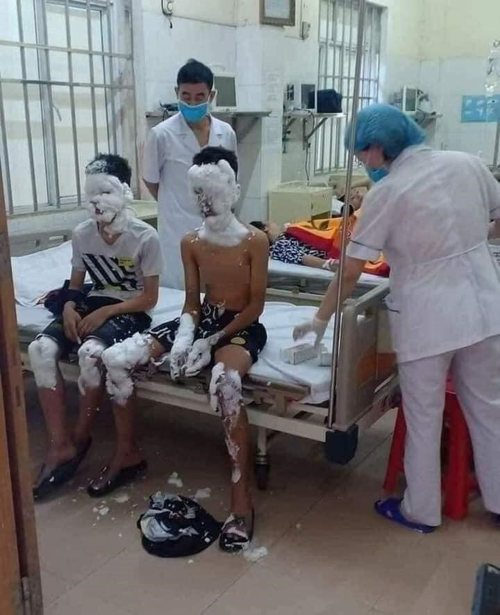 (BCĐ - tin - Thông tin đối ngoại) Hiểm họa pháo tự chế 1