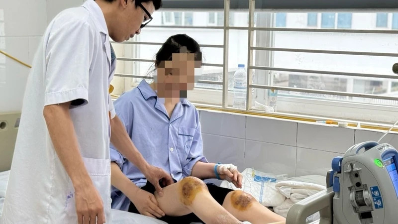 Hoại tử vùng cẳng chân vì chữa bệnh bằng cách dùng ong đốt- Bác sĩ khuyến cáo 