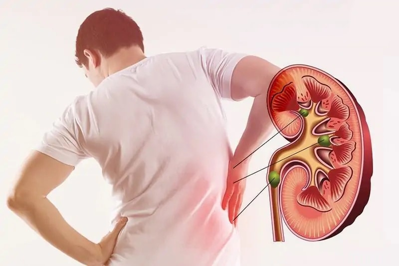 (Tổng hợp) Cách phòng ngừa suy thận bạn nên biết 1