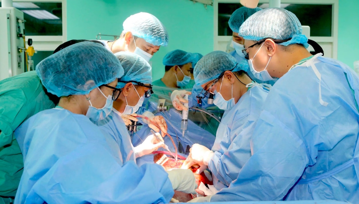 Các bác sĩ BVTW Huế phẫu thuật ghép gan cho bệnh nhi . (Ảnh: BVTW Huế cung cấp)