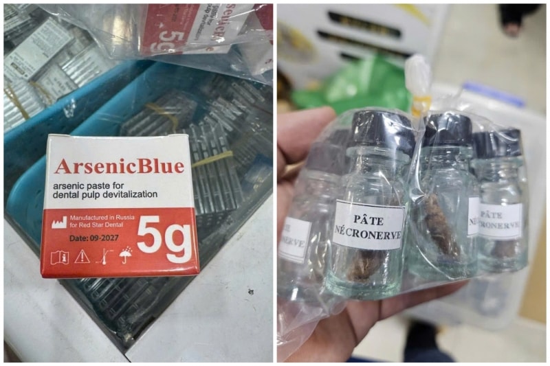 Theo cảnh báo của các chuyên gia, việc sử dụng thạch tín trắng - chất có khả năng gây ung thư và nhiều biến chứng nặng trong điều trị nha khoa là hành vi nguy hiểm. Trong y học hiện đại hiện không còn ứng dụng thạch tín trắng (Ảnh MH)
