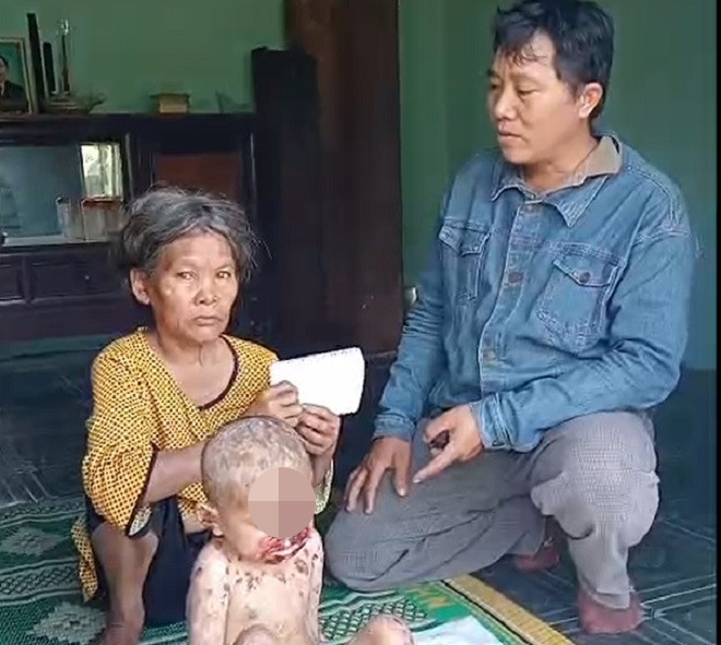 Bệnh lạ