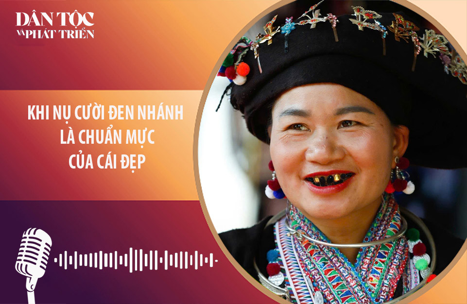 [Podcast] Khi nụ cười đen nhánh là chuẩn mực của cái đẹp 