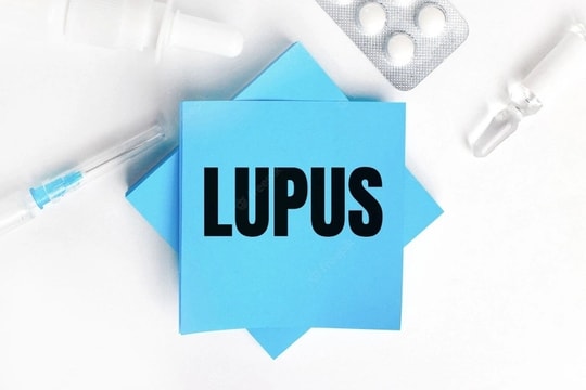 Những điều bạn chưa biết về bệnh Lupus ban đỏ hệ thống