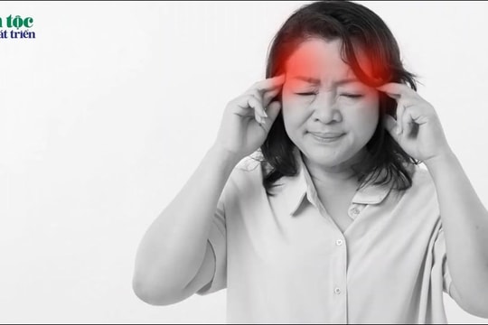 Chữa đau đầu bằng thuốc Nam: Phương pháp tự nhiên và hiệu quả