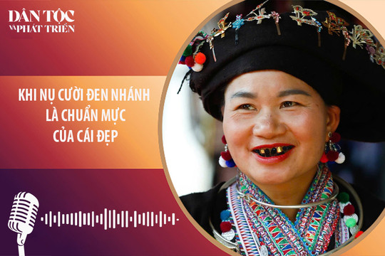 [Podcast] Khi nụ cười đen nhánh là chuẩn mực của cái đẹp