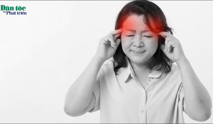 Chữa đau đầu bằng thuốc Nam: Phương pháp tự nhiên và hiệu quả