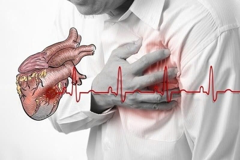 Nhận biết sớm những dấu hiệu cảnh báo - "Thời gian vàng" tránh nhồi máu cơ tim