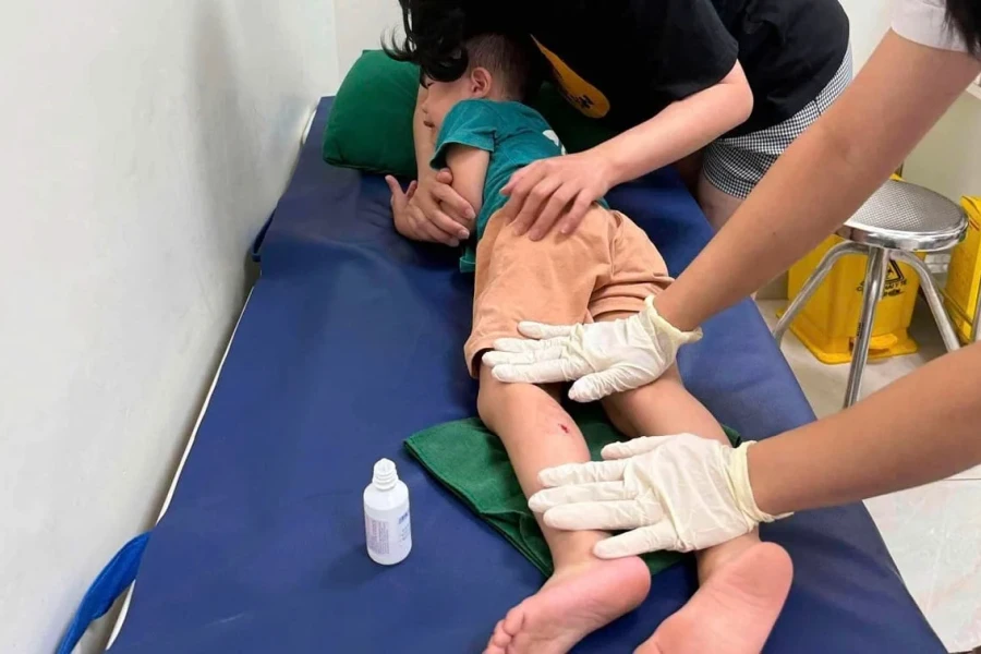 Lạng Sơn: Khỉ liên tiếp xuất hiện ở khu dân cư, bé trai 3 tuổi bị tấn công
