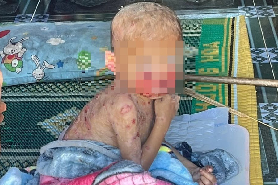 Mang 'bệnh lạ' từ lúc lọt lòng, bé trai vùng cao vẫn chưa có tiền đi chữa